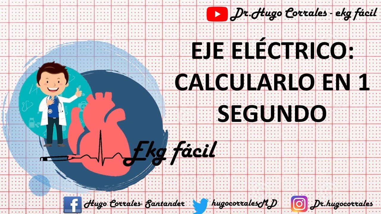 como se calcula el eje electrico